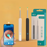 Wireless Visual Earwax Removal with Camera Intelligent Ear Endoscope